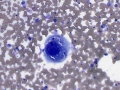 Histiocytic sarcoma (dog)