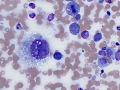 Histiocytic sarcoma (dog)