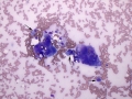 Sarcoma with giant cells (cat)