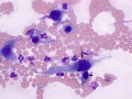 Suspect hemangiosarcoma (dog)