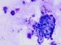 Sebaceous cells