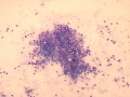 Soft tissue sarcoma (dog)