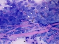 Soft tissue sarcoma (dog)