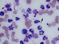 Septic inflammation (dog)