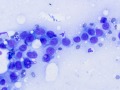 Cutaneous plasmacytosis (rapid stain)