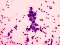 Trichoblastoma (cat)