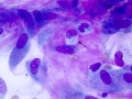 Keloidal fibroma/fibrosarcoma (DQ, dog)