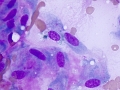 Keloidal fibroma/fibrosarcoma (DQ, dog)