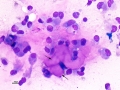 Nerve sheath tumor (dog)