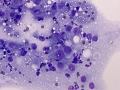Granulomatous inflammation (cat)