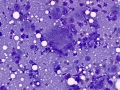 Granulomatous inflammation (cat)