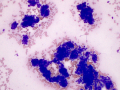 Trichoblastoma (dog)