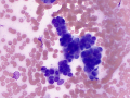 Trichoblastoma (dog)