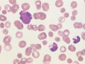 LE cell & "ragocyte" (dog)