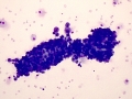 Mucopolysaccharidosis (dog)