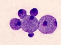 Mucopolysaccharidosis (dog)