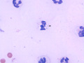 Sepsis (dog)