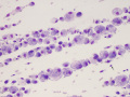 Villonodular synovitis (dog)