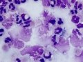 Sepsis (bovine)