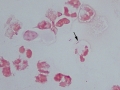 Sepsis (bovine)