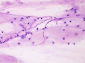 Mucus spirals (horse)