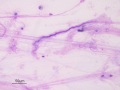 Mucus spiral (horse)