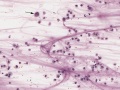 Multinucleated giant cell (horse)
