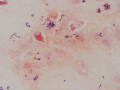 Rhodococcus equi (horse, gram)