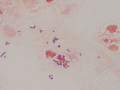 Rhodococcus equi  (horse, gram)