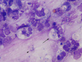 Rhodococcus equi (horse, Wright's)