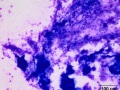 Aspergillus pneumonia (horse)