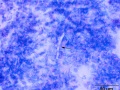 Aspergillus pneumonia (horse)