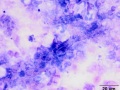 Aspergillus pneumonia (horse)