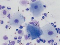 Oropharyngeal contamination & sepsis