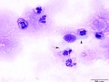 Streptococcus zooepidemicus (horse)