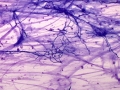 Aspergillus (horse)