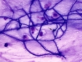 Aspergillus (horse)
