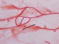 Aspergillus (horse)