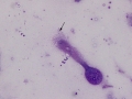 Mycoplasma (bovine)
