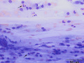 Eosinophilic bronchopneumopathy (dog)
