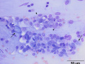 Eosinophilic bronchopneumopathy (dog)