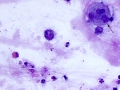 Mixed inflammation (horse)