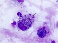 Mixed inflammation (horse)