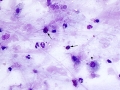 Mixed inflammation (horse)