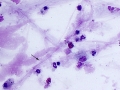 Mixed inflammation (horse)