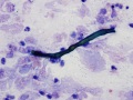 Dematiaceous fungus (horse)