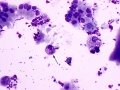Macrophage inclusions (dog)
