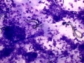 Lungworm (goat)