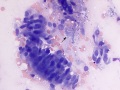 Columnar epithelial cells and mucin