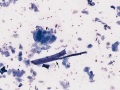 Oropharyngeal contamination (horse)